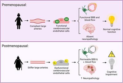 Sex Differences in Large Artery Stiffness: Implications for Cerebrovascular Dysfunction and Alzheimer’s Disease